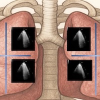 OA2